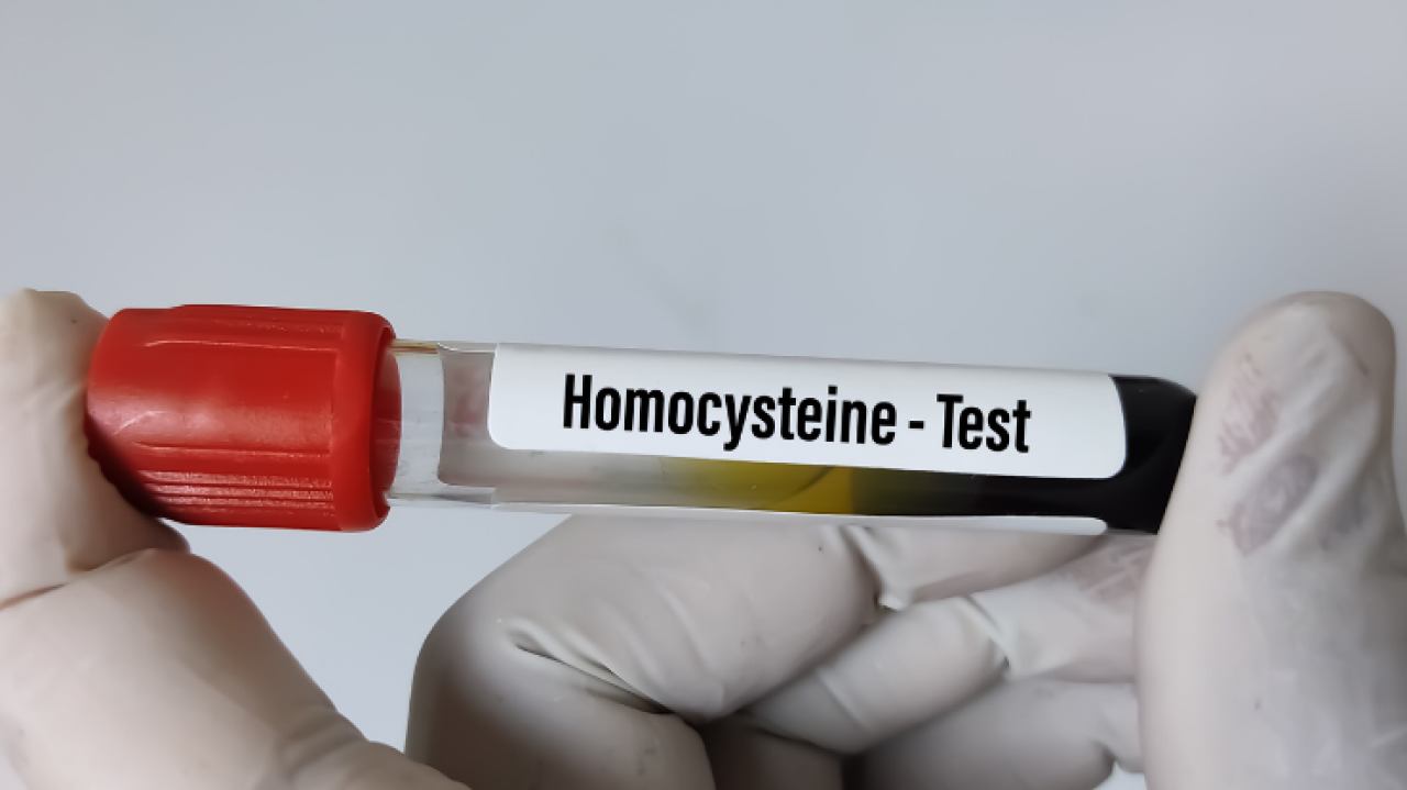 Homosistein Nedir?