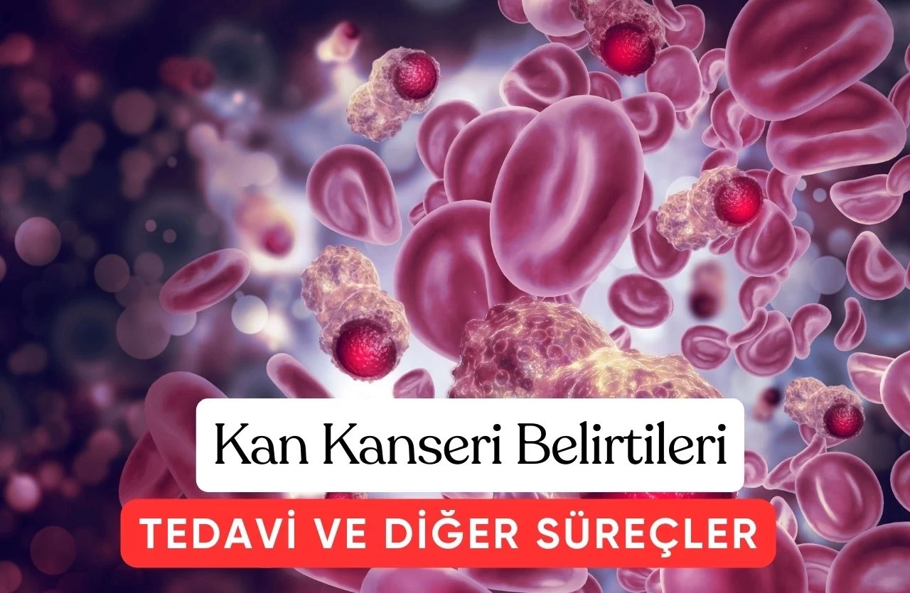 Kan Kanseri: Belirtileri, Türleri Ve Tedavi Süreçleri