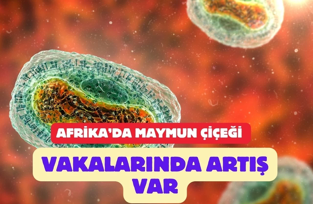 Maymun Çiçeği Afrika’da Yayılmaya Devam Ediyor: 30 Bin Vaka Görüldü!