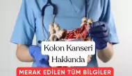 Kolon Kanseri Belirtileri, Teşhisi Ve Tedavi Yolları