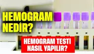 Hemogram Nedir? Hemogram Testi Nasıl Yapılır?