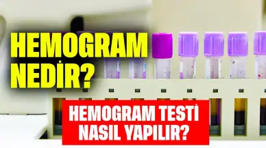 Hemogram Nedir? Hemogram Testi Nasıl Yapılır?