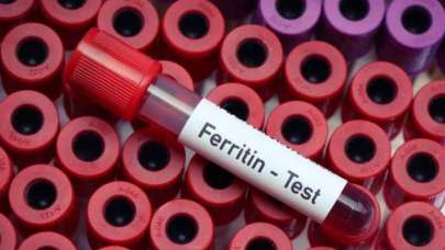 Ferritin Az Olursa Ne Olur?