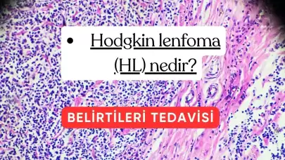 HODGKIN LENFOMA (HL) NEDİR?