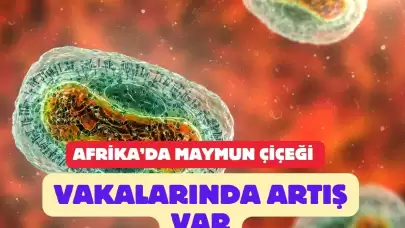 Maymun Çiçeği Afrika’da Yayılmaya Devam Ediyor: 30 Bin Vaka Görüldü!