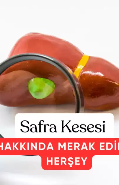 Safra Kesesi Nedir Safra Kesesi Hakkında Merak Edilenler