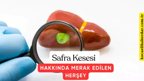 Safra Kesesi Nedir Safra Kesesi Hakkında Merak Edilenler