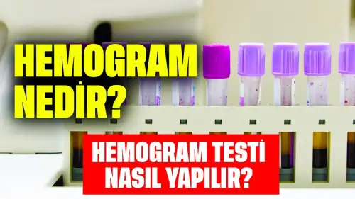 Hemogram Nedir? Hemogram Testi Nasıl Yapılır?