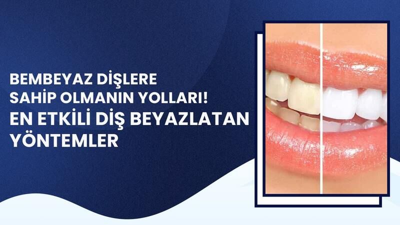 Bembeyaz Dişlere Sahip Olmanın Yolları! En Etkili Diş Beyazlatan Yöntemler