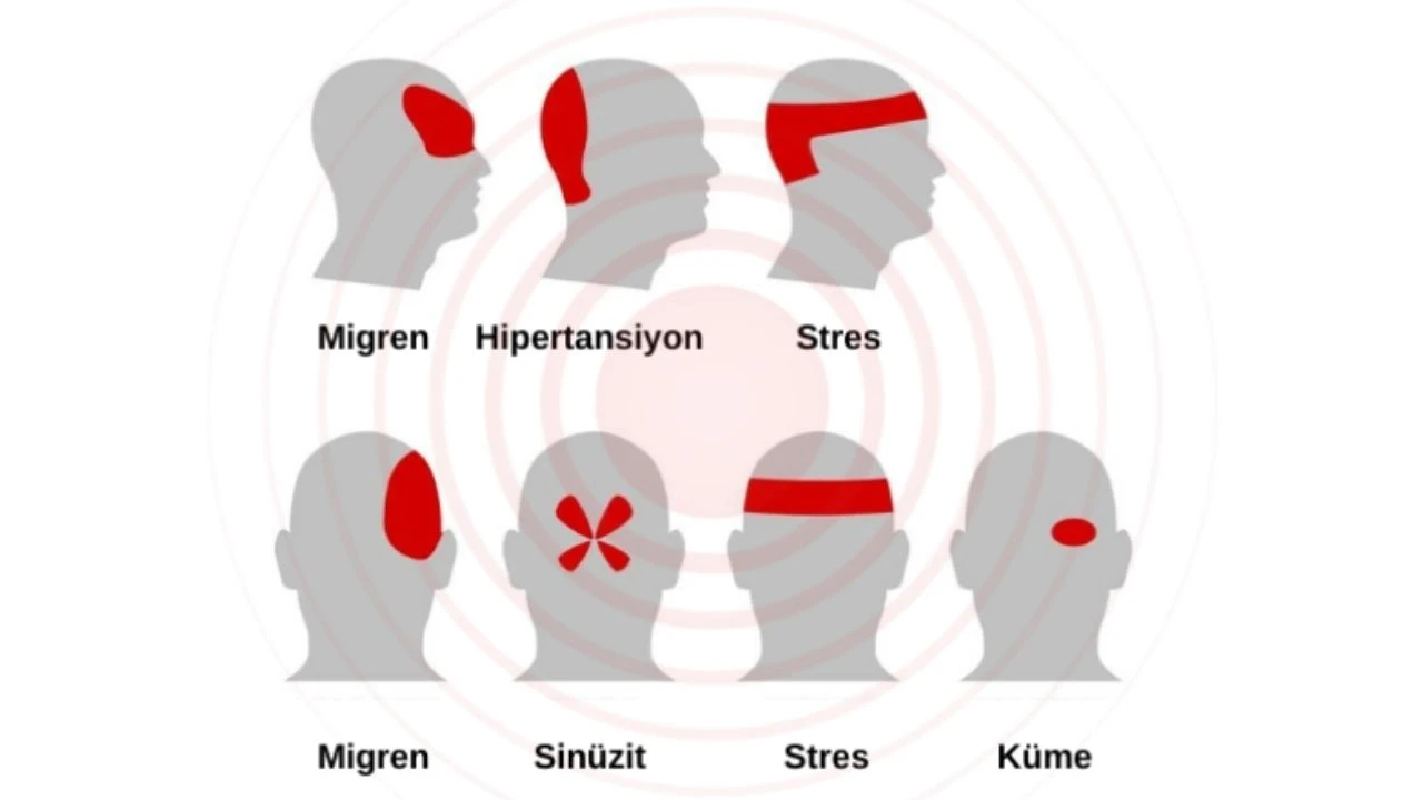 bas-agrisi-nedenleri-belirtileri-ve-nasil-basa-cikilir